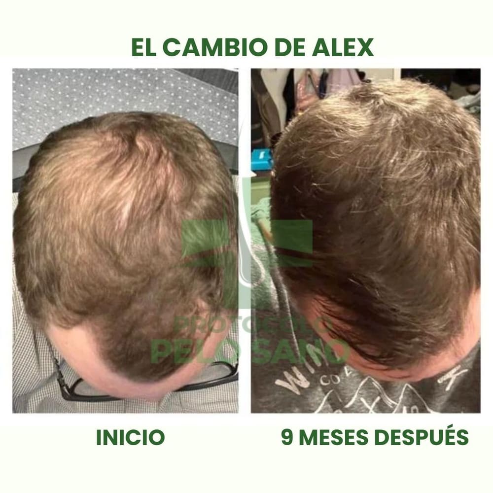 Evolución real · 9 meses después