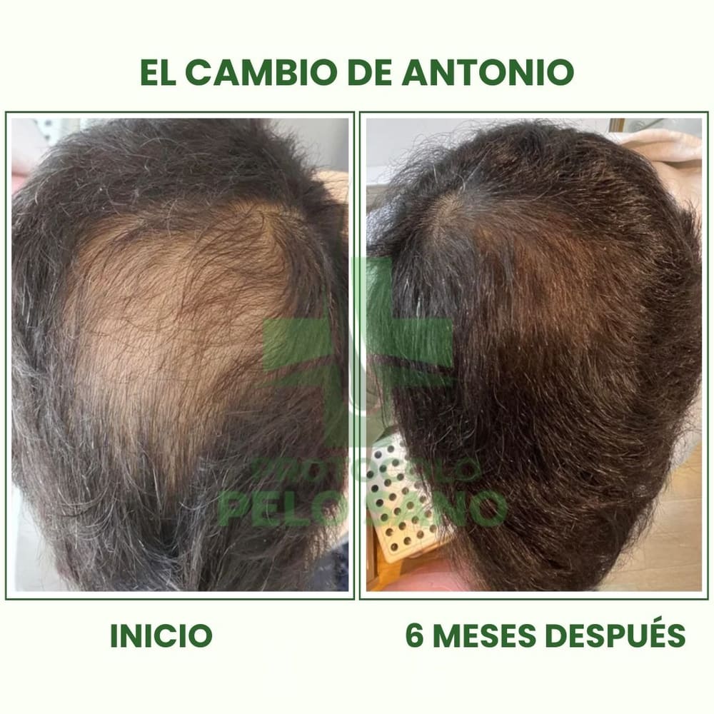 Evolución real · 6 meses después