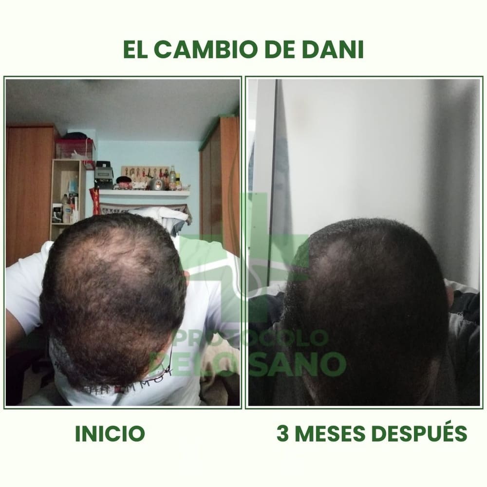 Evolución real · 3 meses después