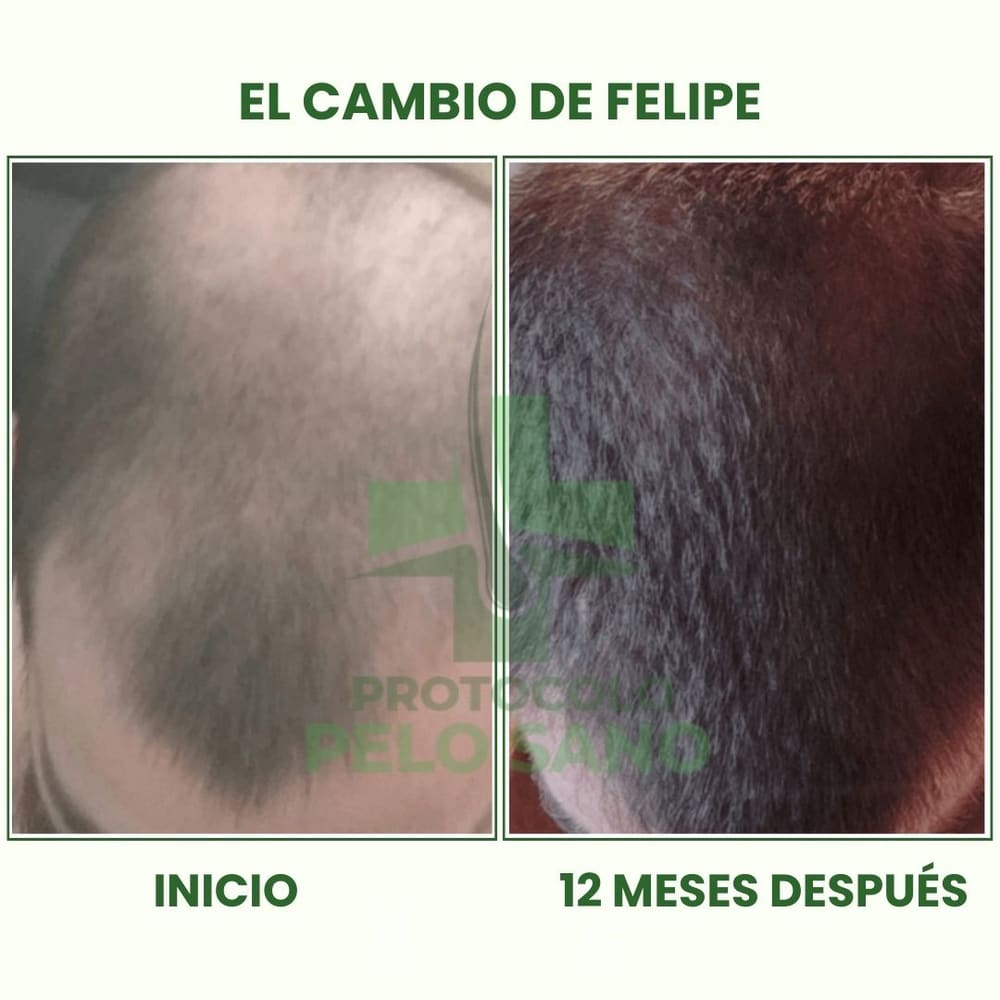 Evolución real: 12 meses después