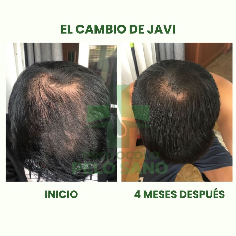 Evolución real · 4 meses después