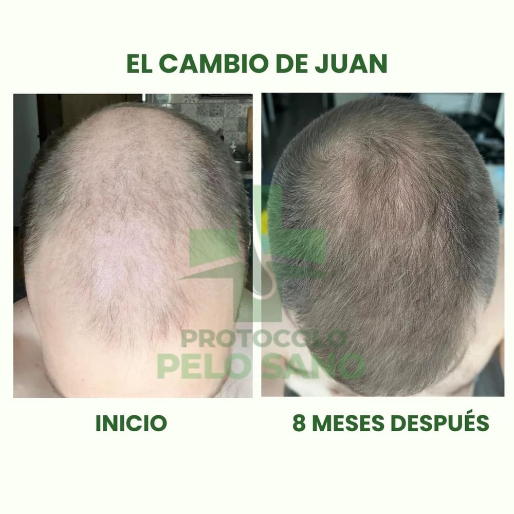 Evolución real · 8 meses después