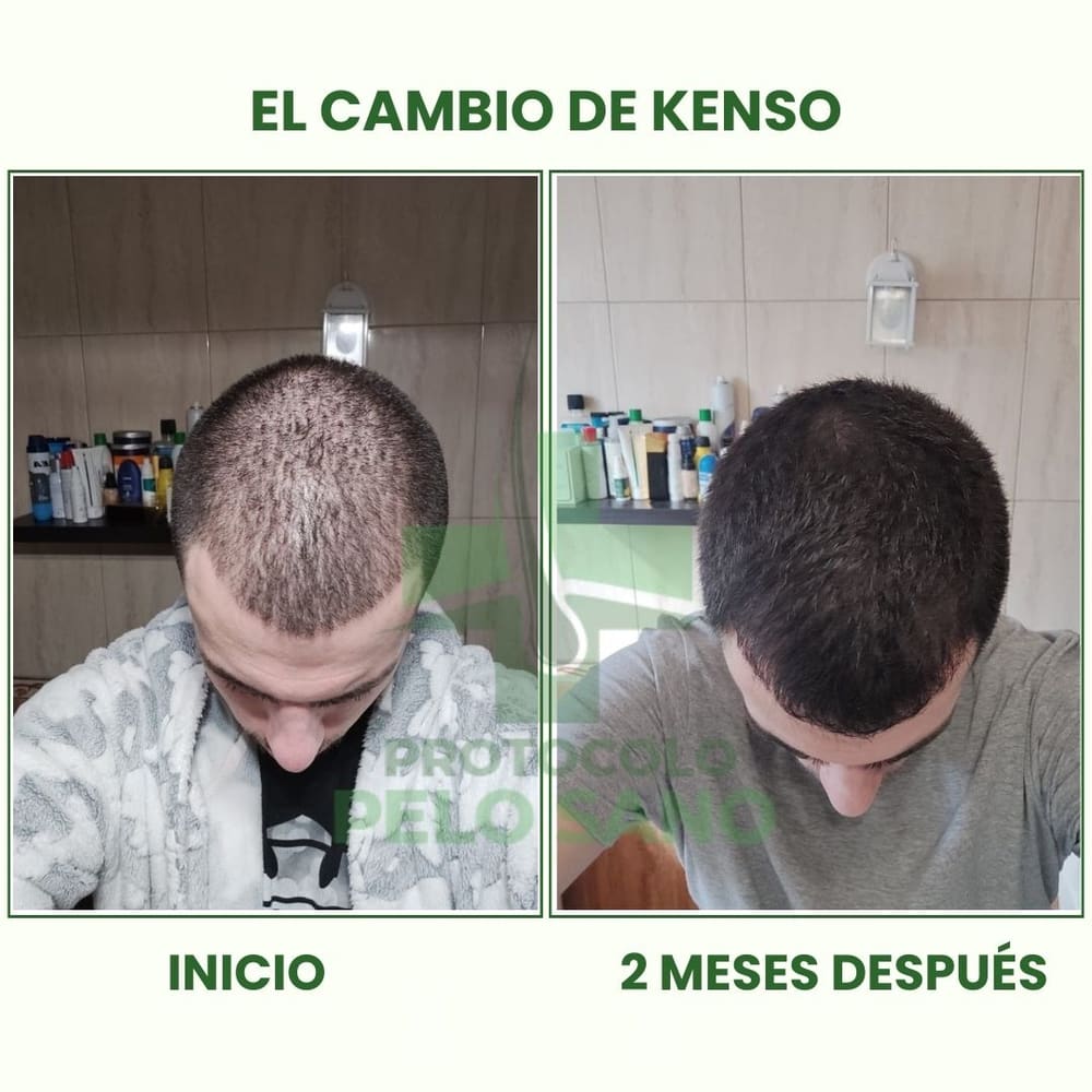 Evolución real · 2 meses después