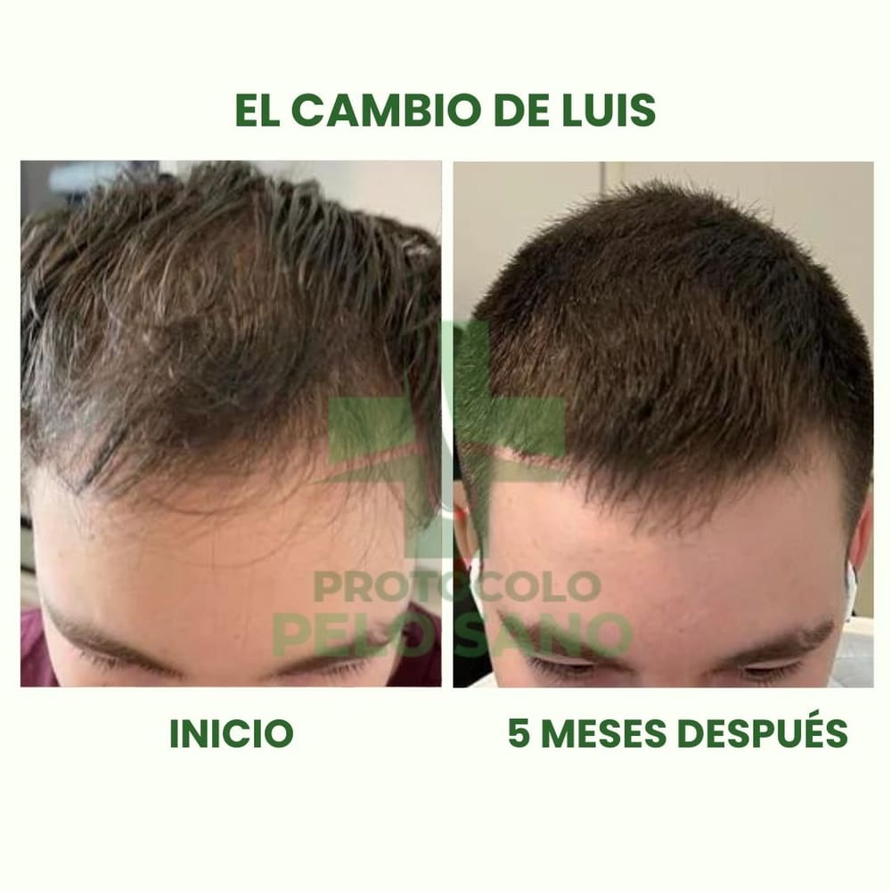 Evolución real · 5 meses después