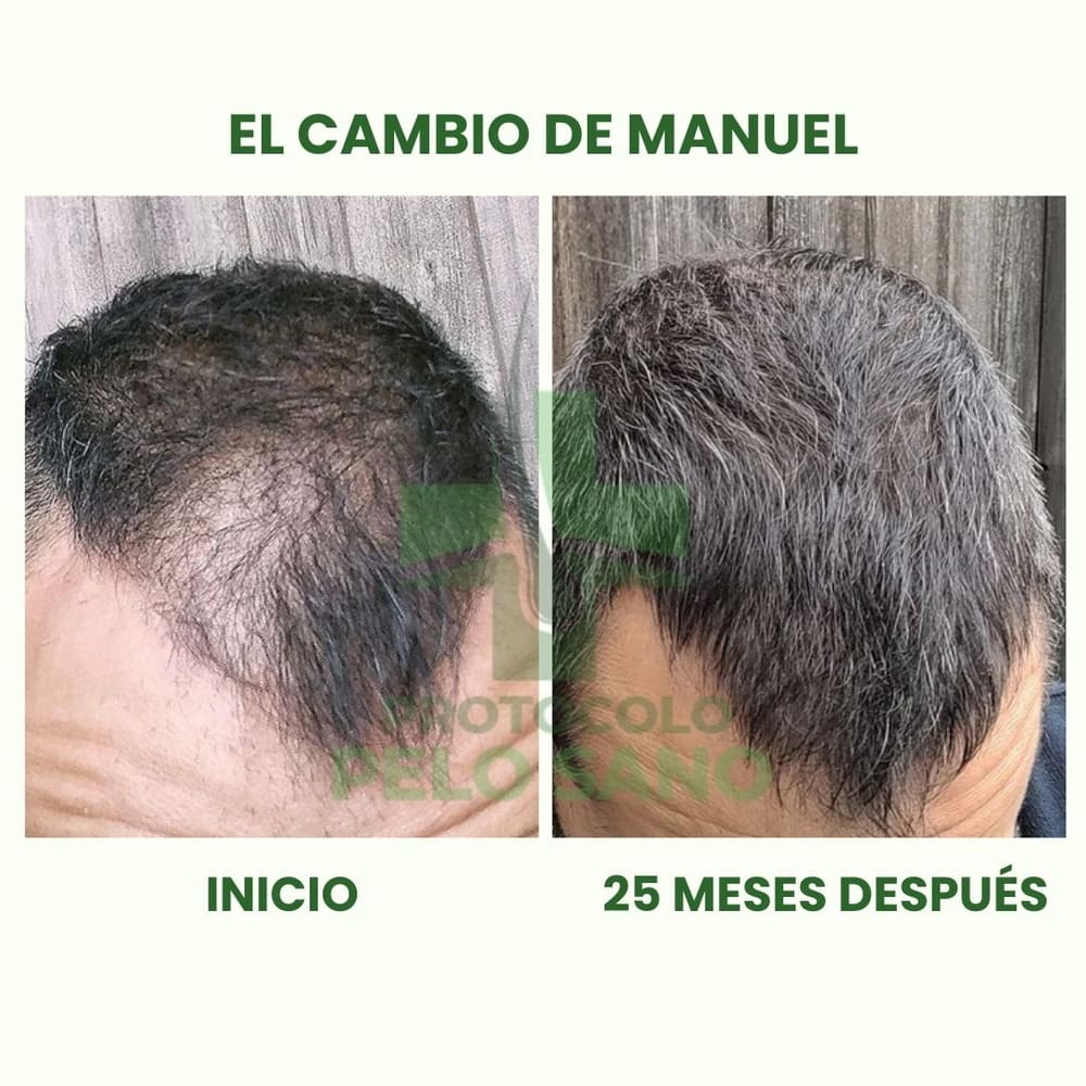 Evolución real: 25 meses después