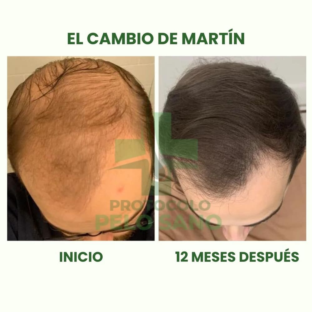 Evolución real · 12 meses después