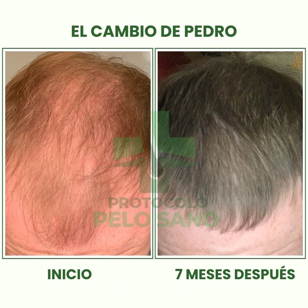 Evolución real · 7 meses después