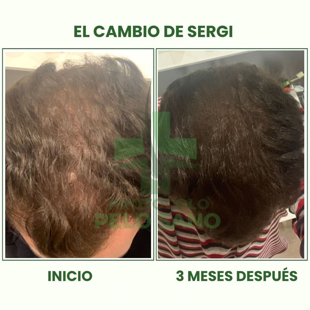 Evolución real · 3 meses después