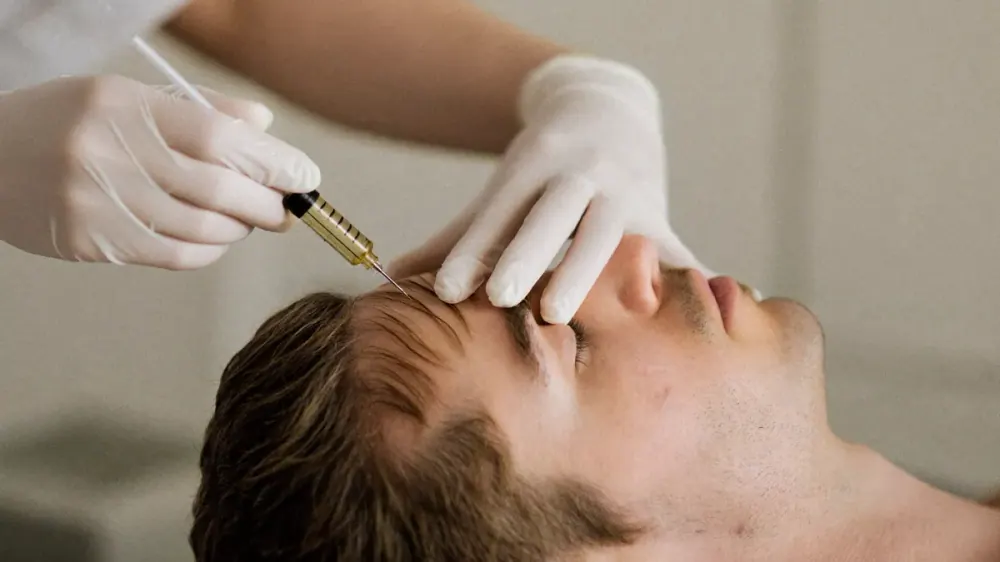 Mesoterapia capilar: microinyecciones superficiales repartidas por el cuero cabelludo