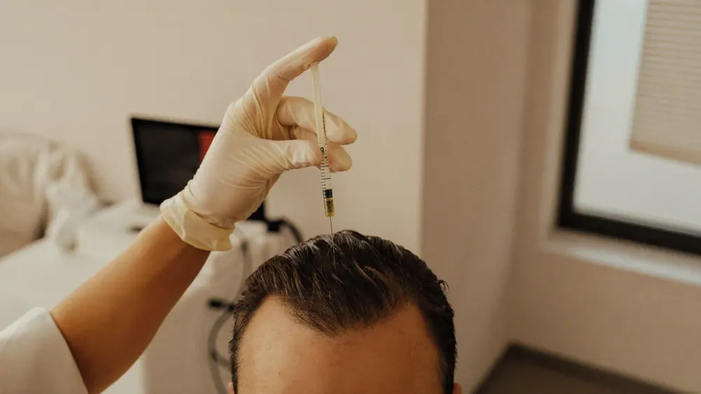 Mesoterapia capilar: para qué sirve y si merece la pena