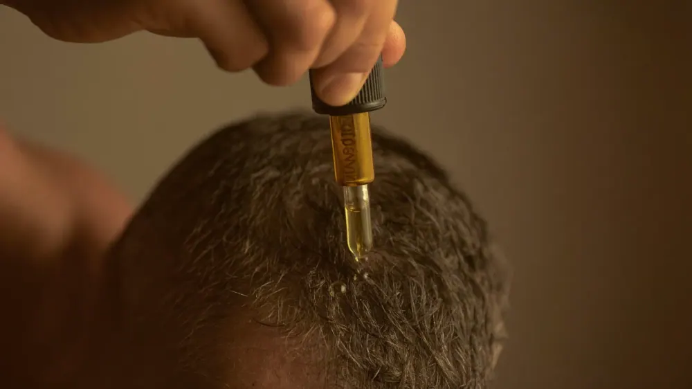 Minoxidil: para qué sirve y cómo se usa bien