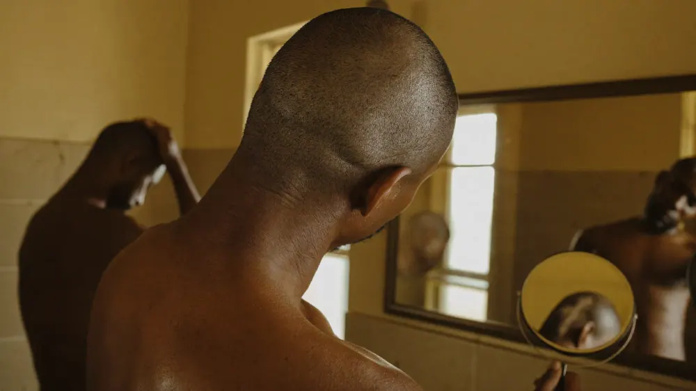 Tipos de alopecia: cómo saber cuál tienes tú