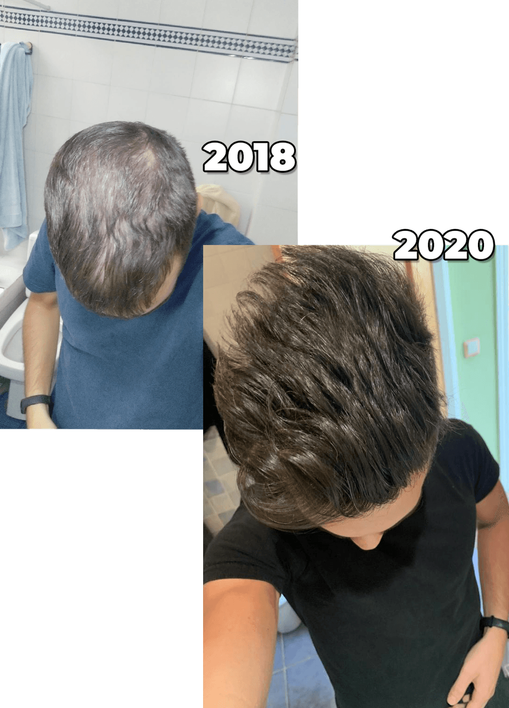 Mi pelo en 2018 y en 2020