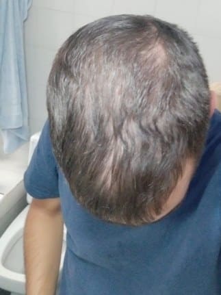 Mi antes
